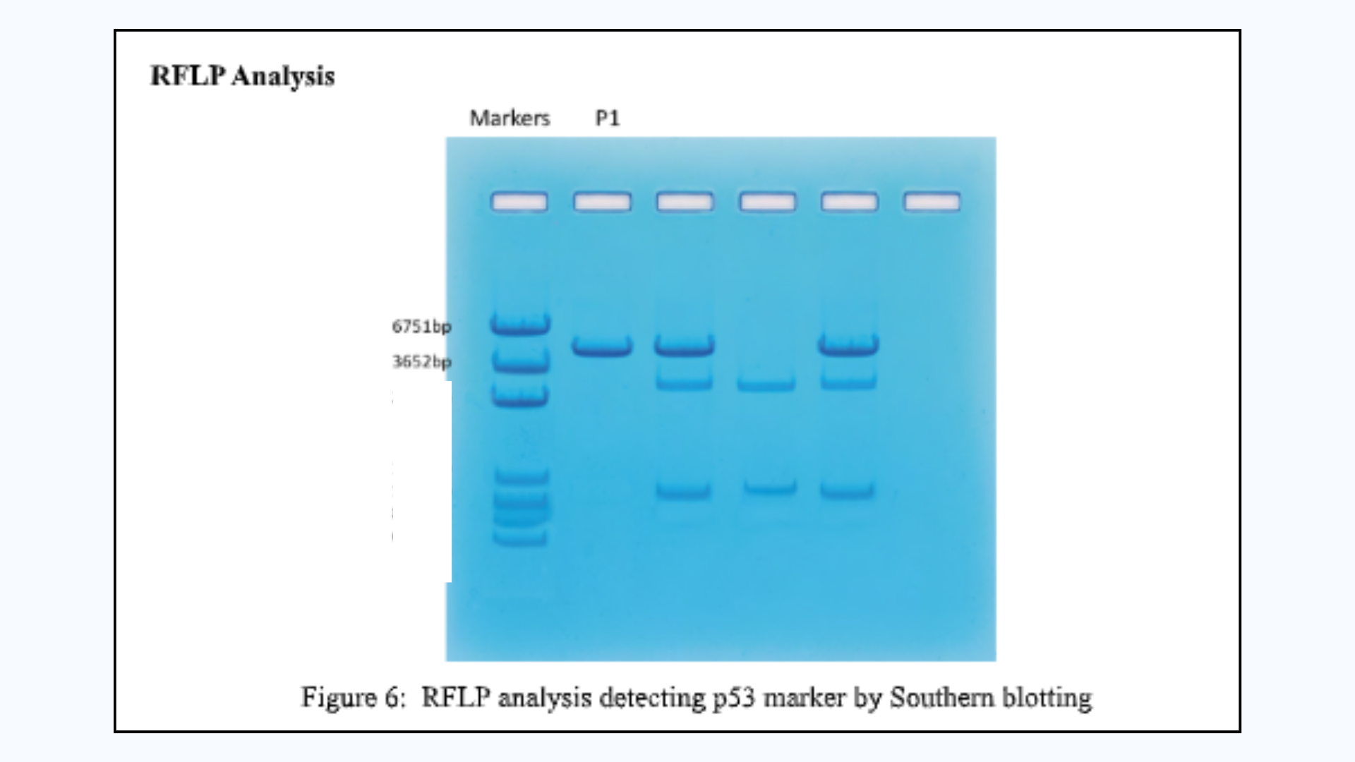 P53 cancer gene RFLP