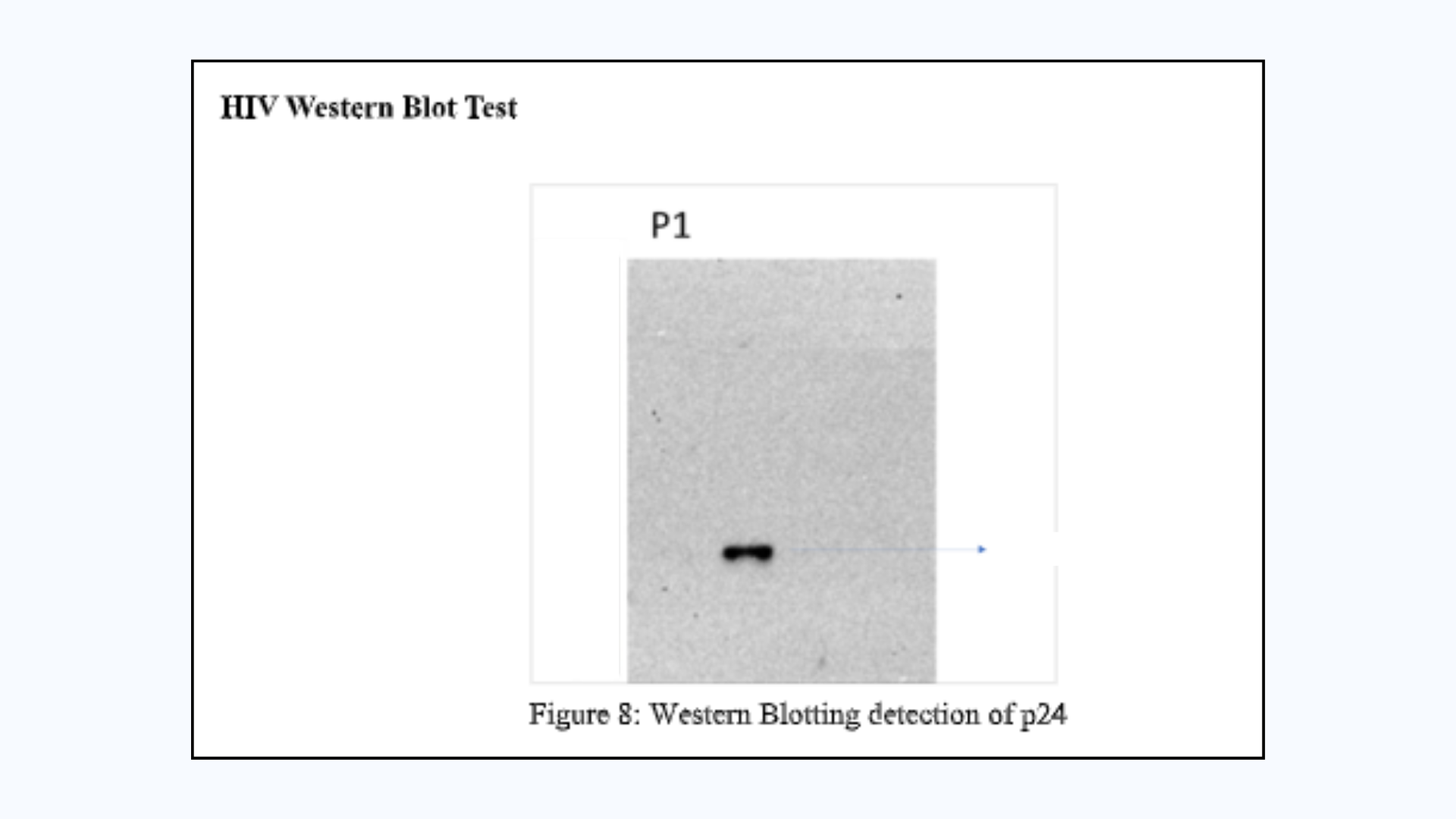 HIV - 1 anti-Gag p24 Western blot