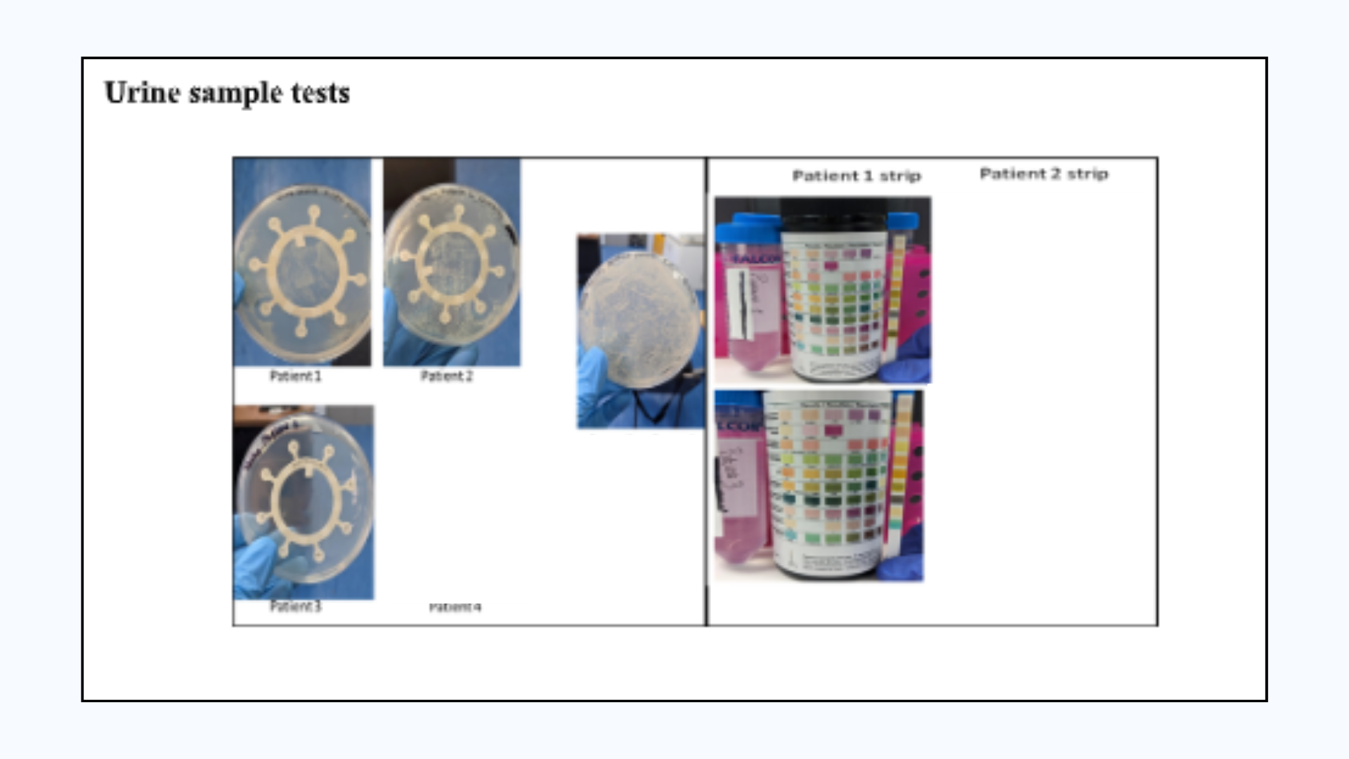 Urine sample results