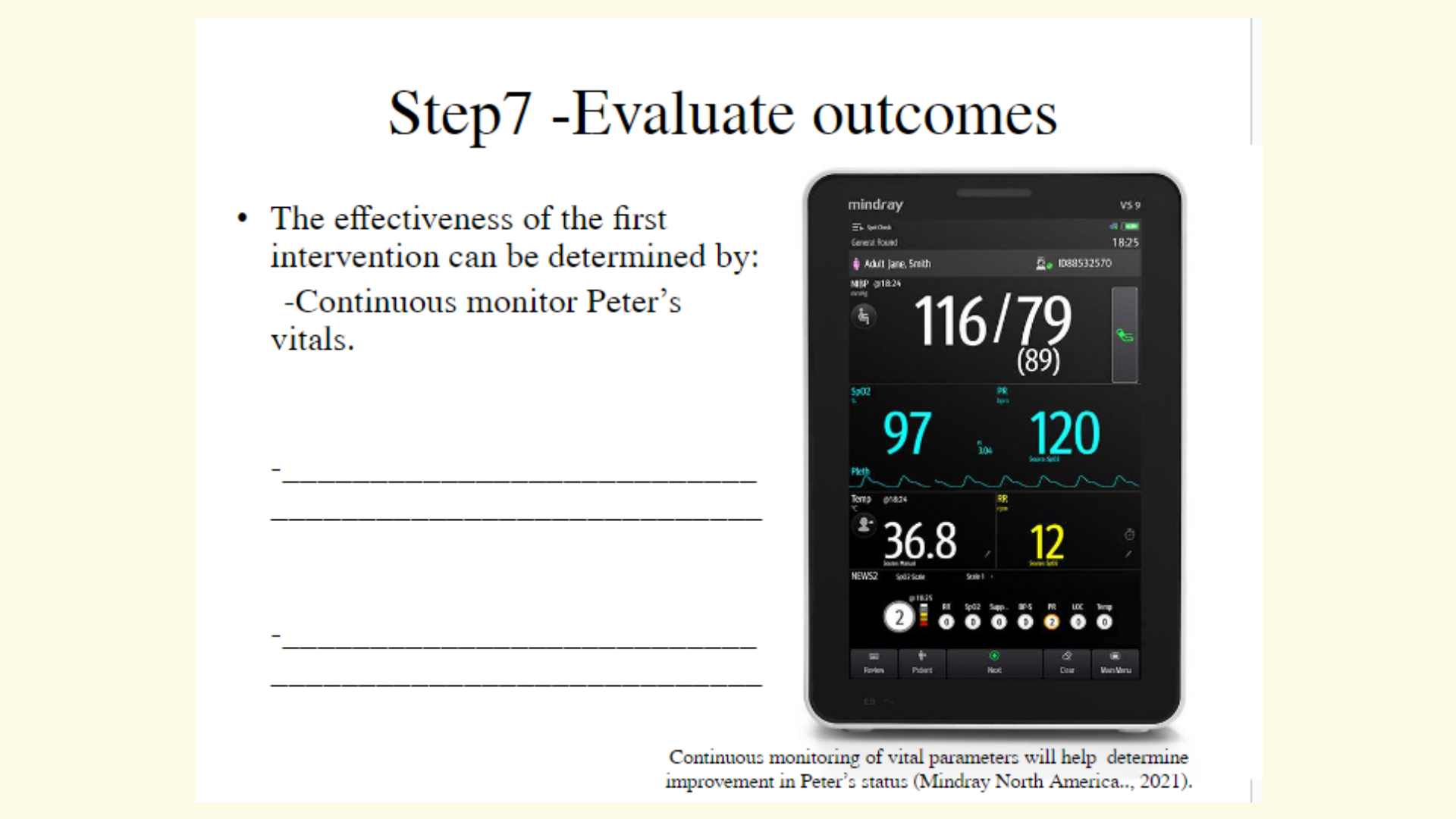 NURBN3030 Slide 15