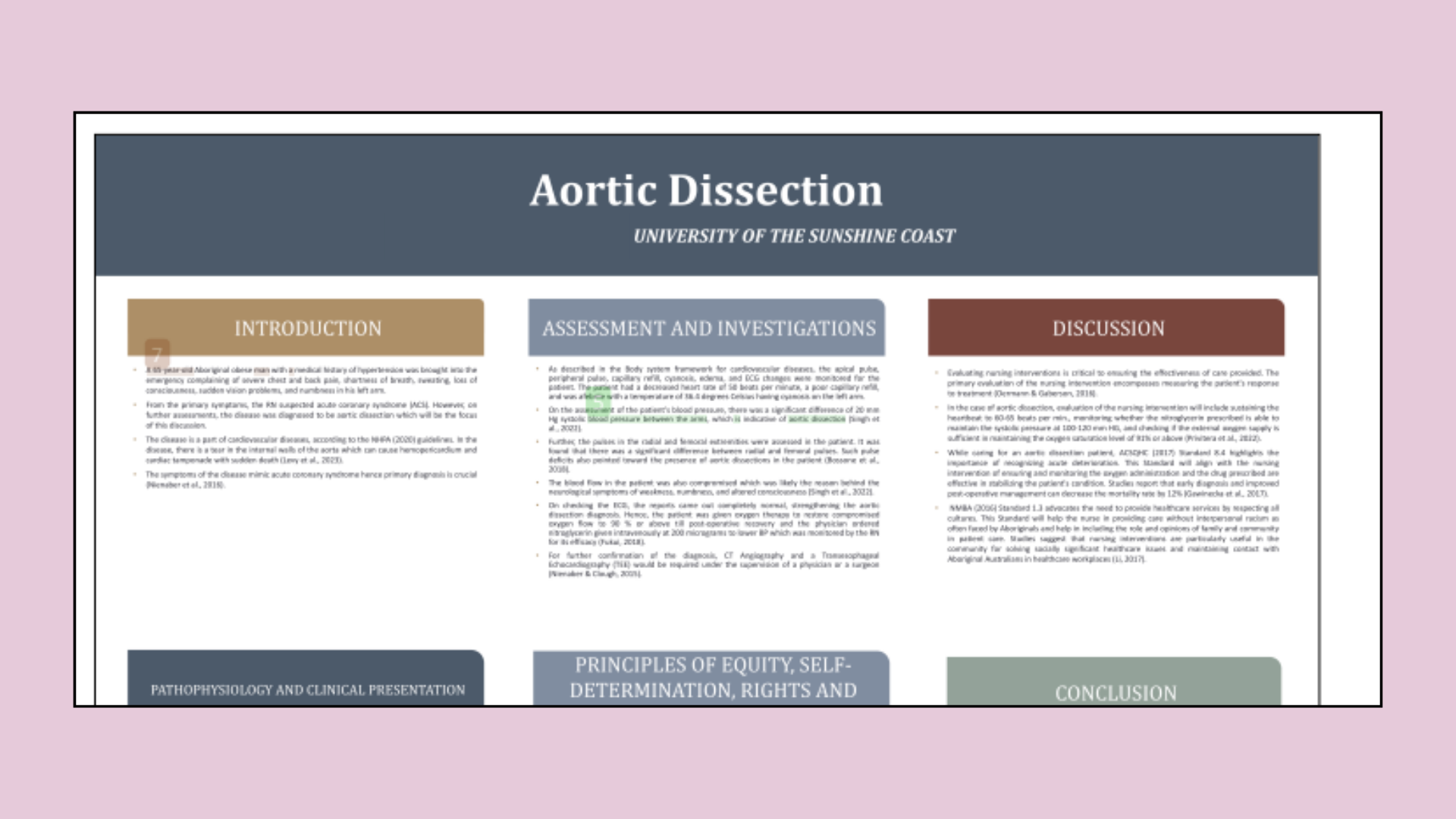 Aortic Dissection