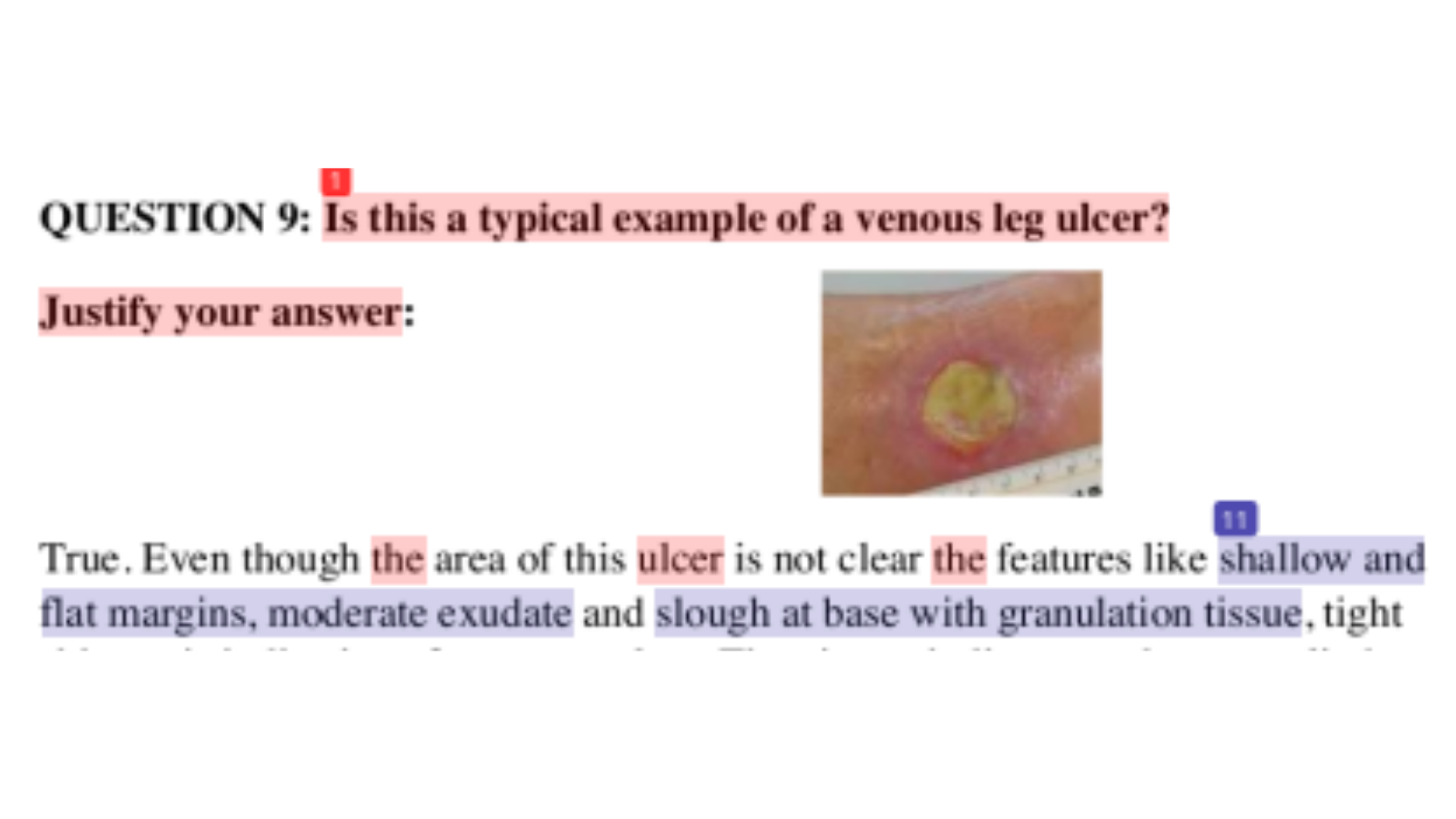 NSB608 Question 9